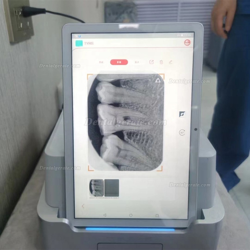 TYRIS TR310 speicherfolienscanner zahnarzt mit Pad und speicherfolie zahnfilm
